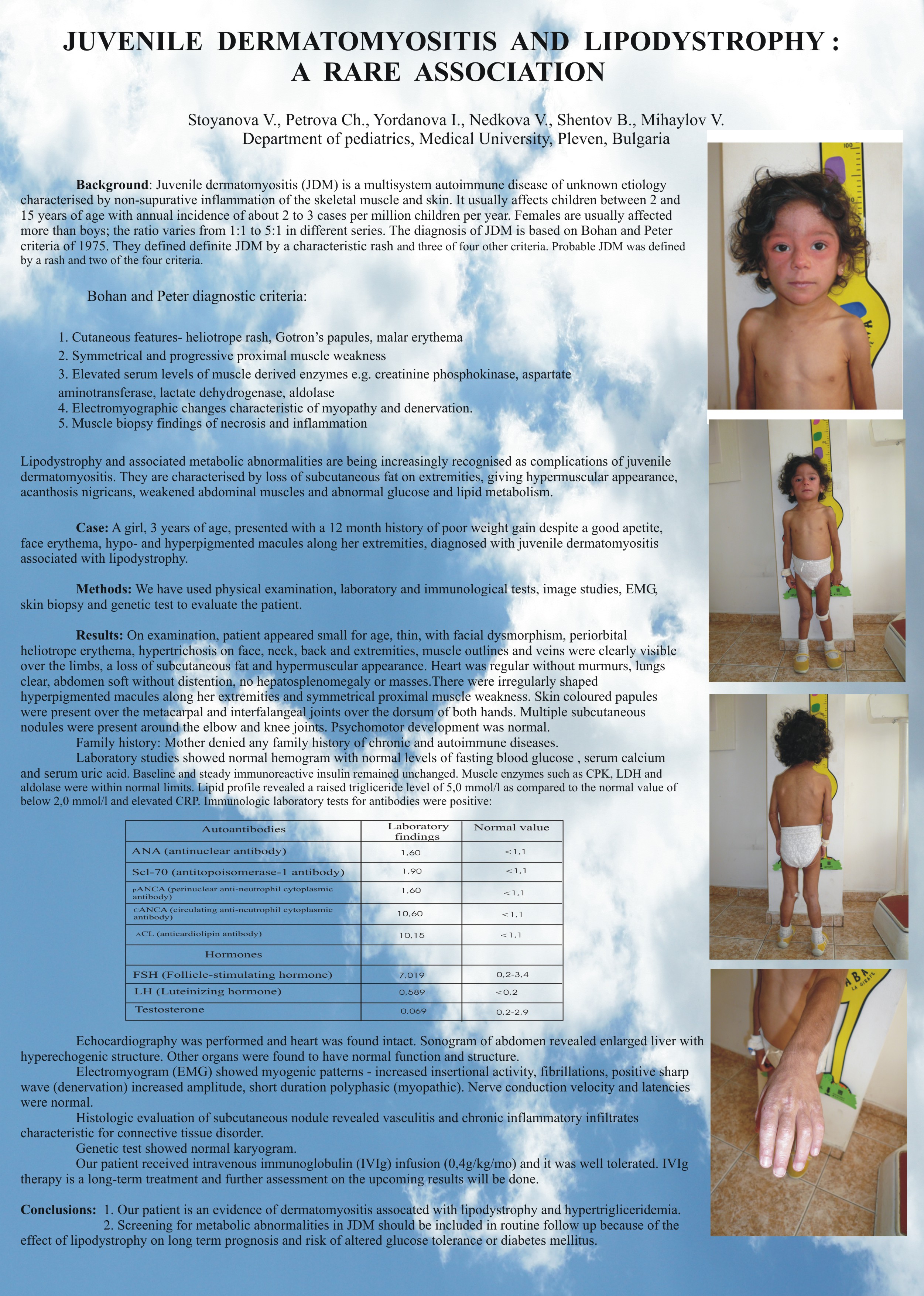 Anton syndrome case report poster